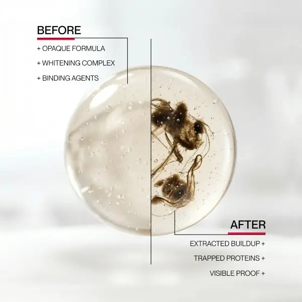 Before and after illustration of oral buildup binding formula